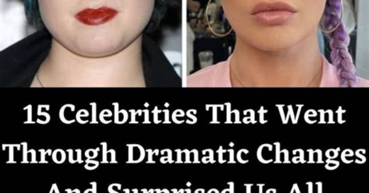 15 Celebrities Who Went