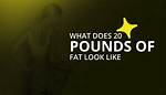 20 Pounds of Fat: Understanding Its Impact on Health and Lifestyle