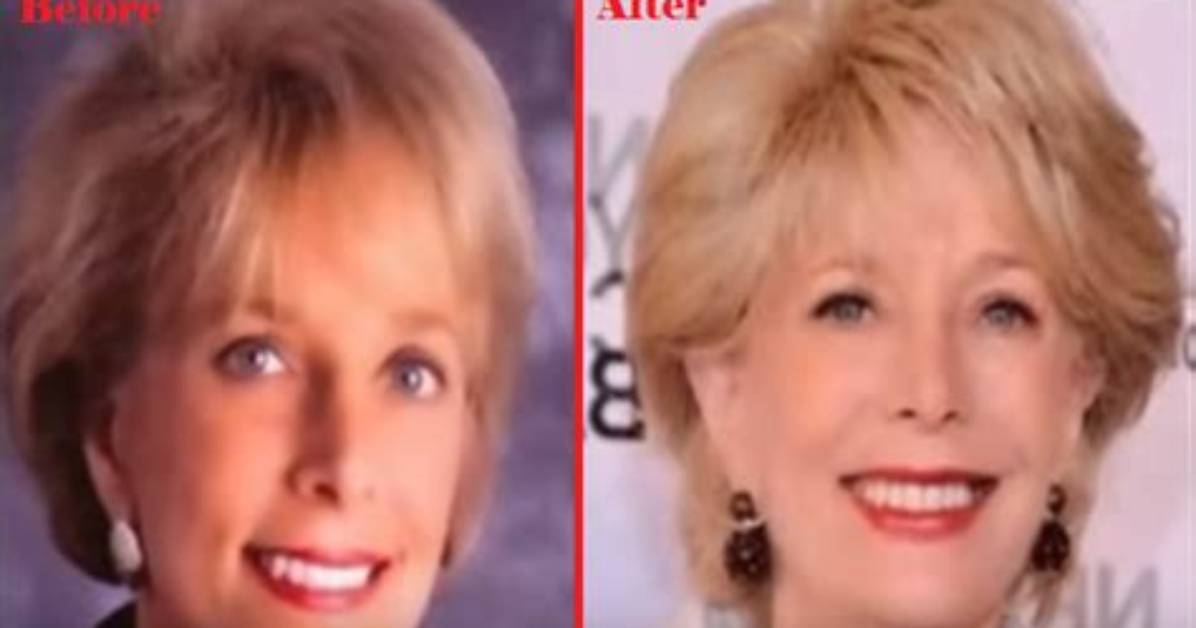 60 Minutes: Did Leslie Stahl Undergo Facelift? American Journalist’s New Look Explored