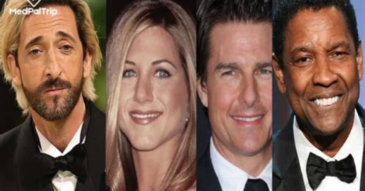 A-List Celebrities with Crooked Noses: Embracing Imperfections