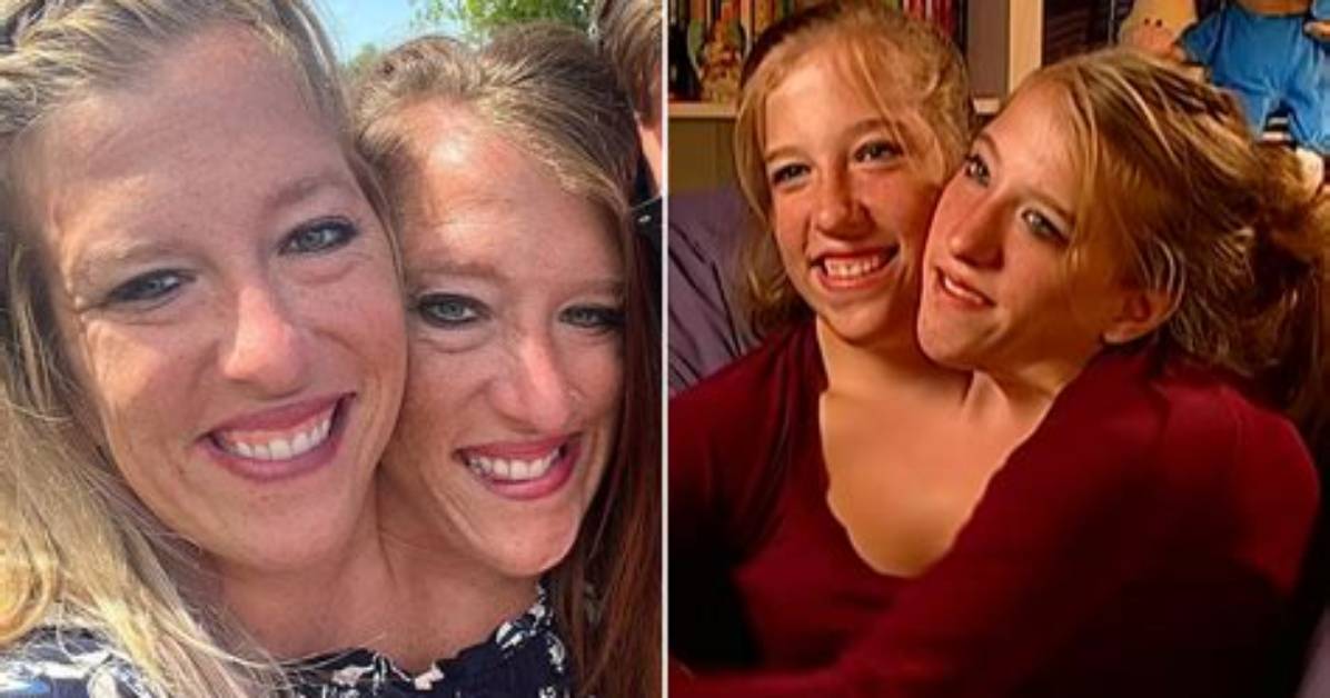 Abby and Brittany Hensel Now Separated