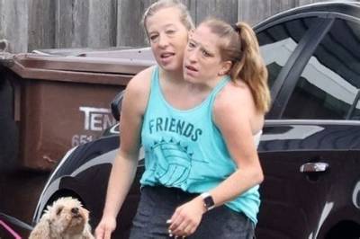 Abby and Brittany: the Journey of Conjoined Twins and Their Legacy
