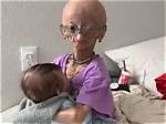 Adalia Rose Death News, Who Are Her Parents? Natalia Pallante and Biological Father