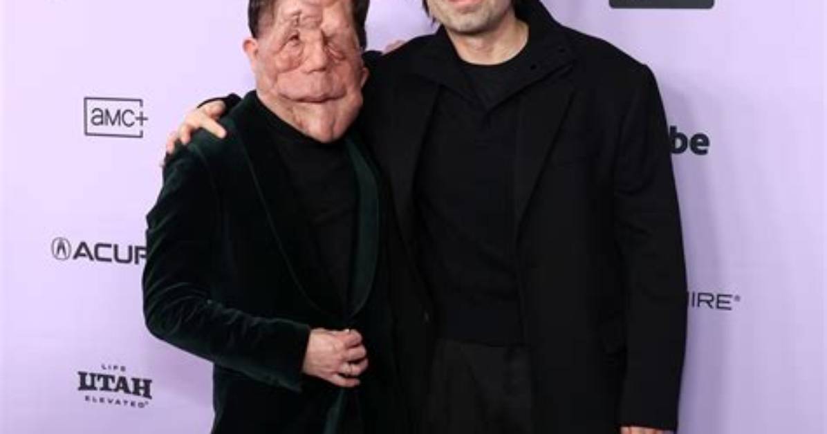Adam Pearson Height: a Detailed Look into His Life, Career, and Influence