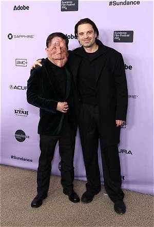 Adam Pearson Height: a Detailed Look into His Life, Career, and Influence