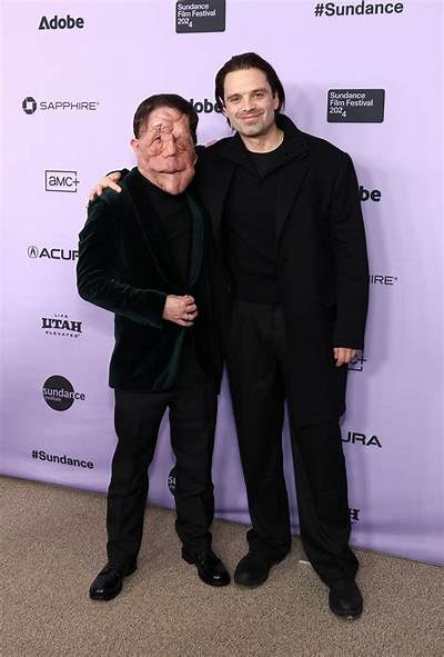 Adam Pearson Height: a Detailed Look into His Life, Career, and Influence
