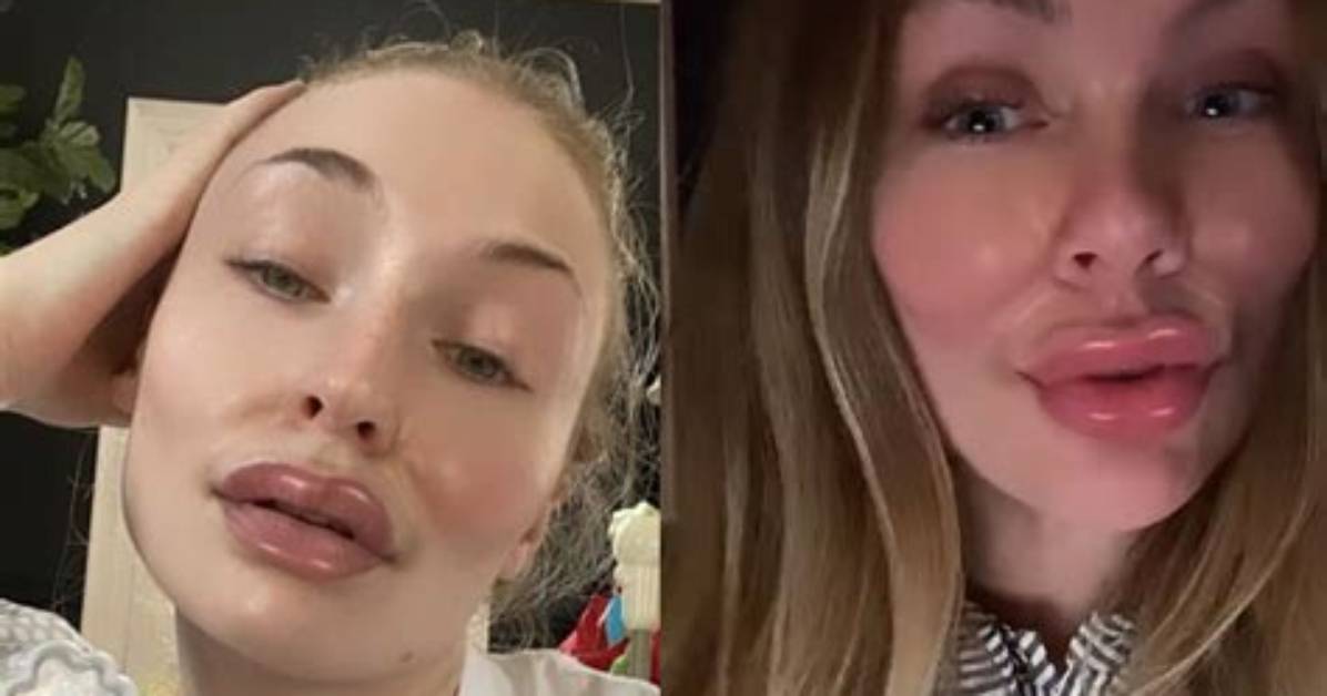 Alyssa Mckay Plastic Surgery Viral on Tiktok: Before and After Photo