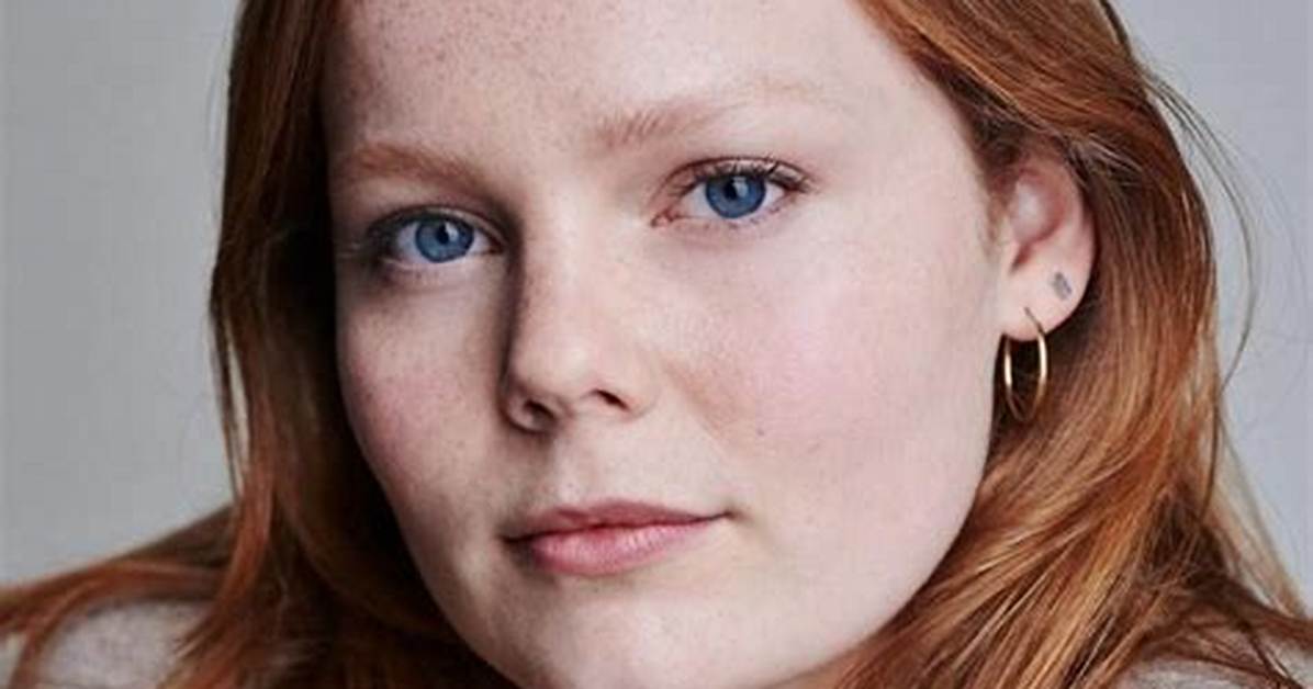 Anna Burnett