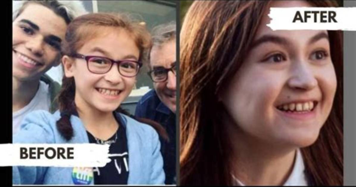 Anna Cathcart Missing Teeth Theory Debunked