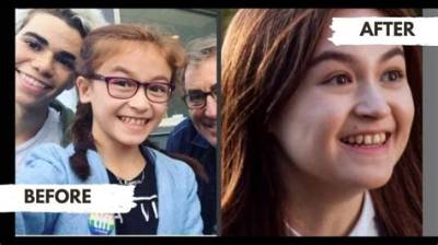 Anna Cathcart Missing Teeth Theory Debunked