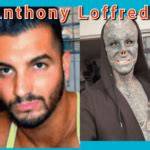 Anthony Loffredo Age Wiki Biography, Instagram: Black Alien Guy Before Transformation