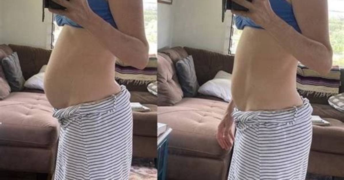 Are Belly Pooch Normal?