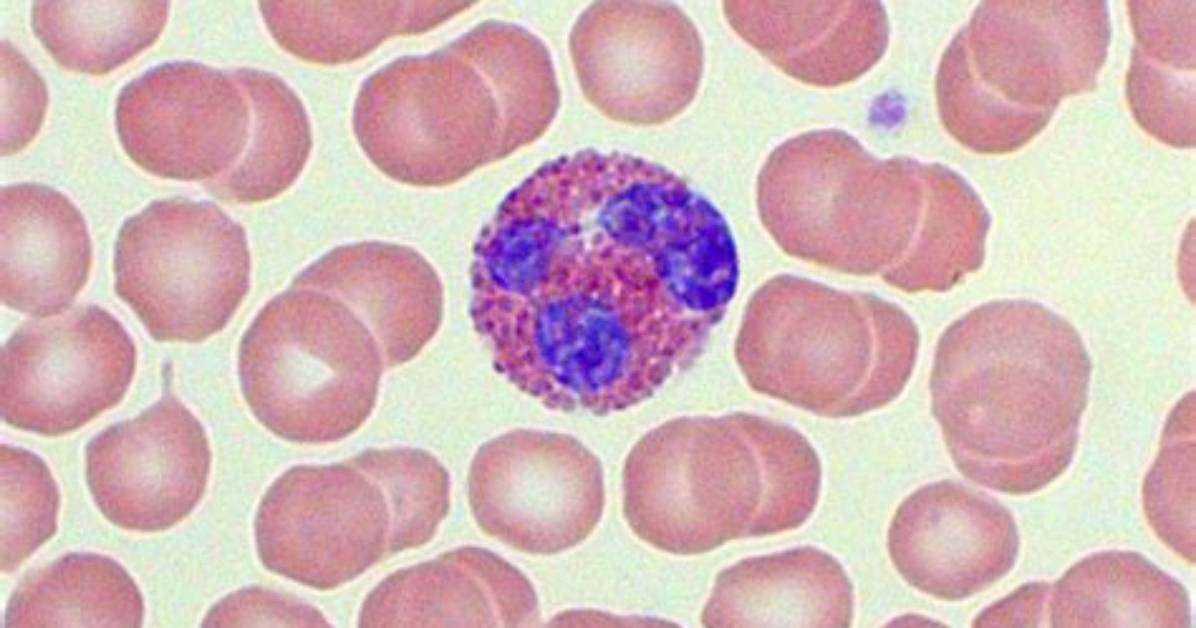 Are Eosinophils White Blood