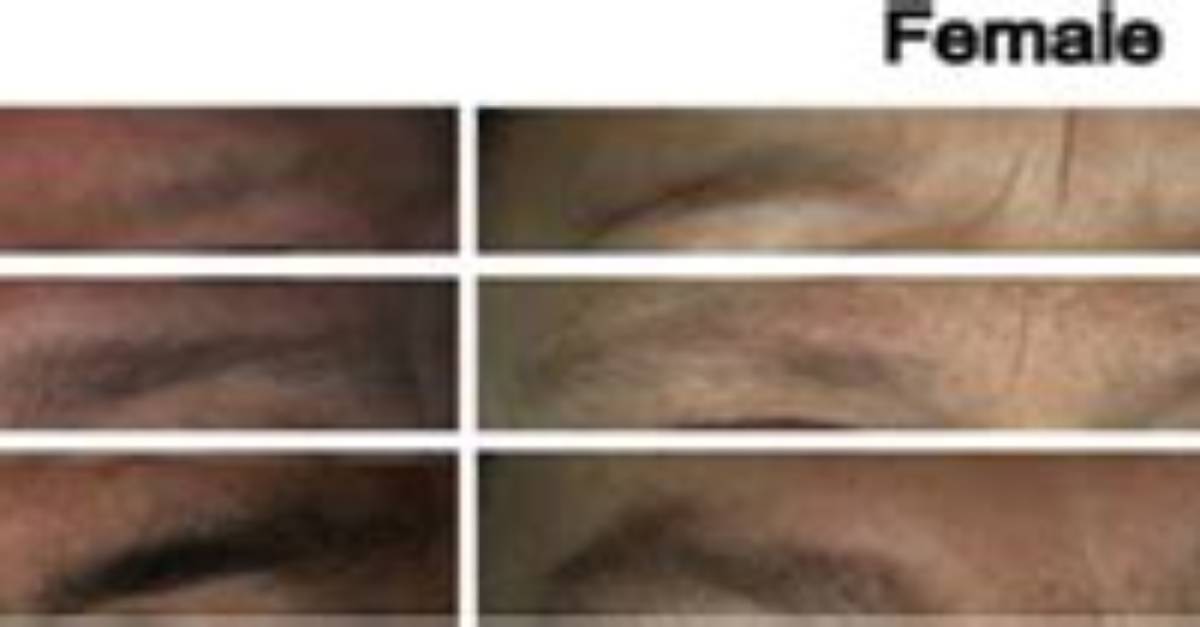 Are Eyebrows Genetic?