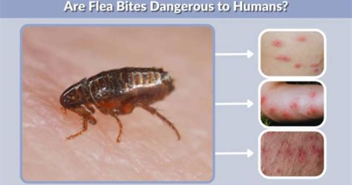 Are Flea Bite Dangerous?