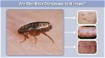 Are Flea Bite Dangerous?