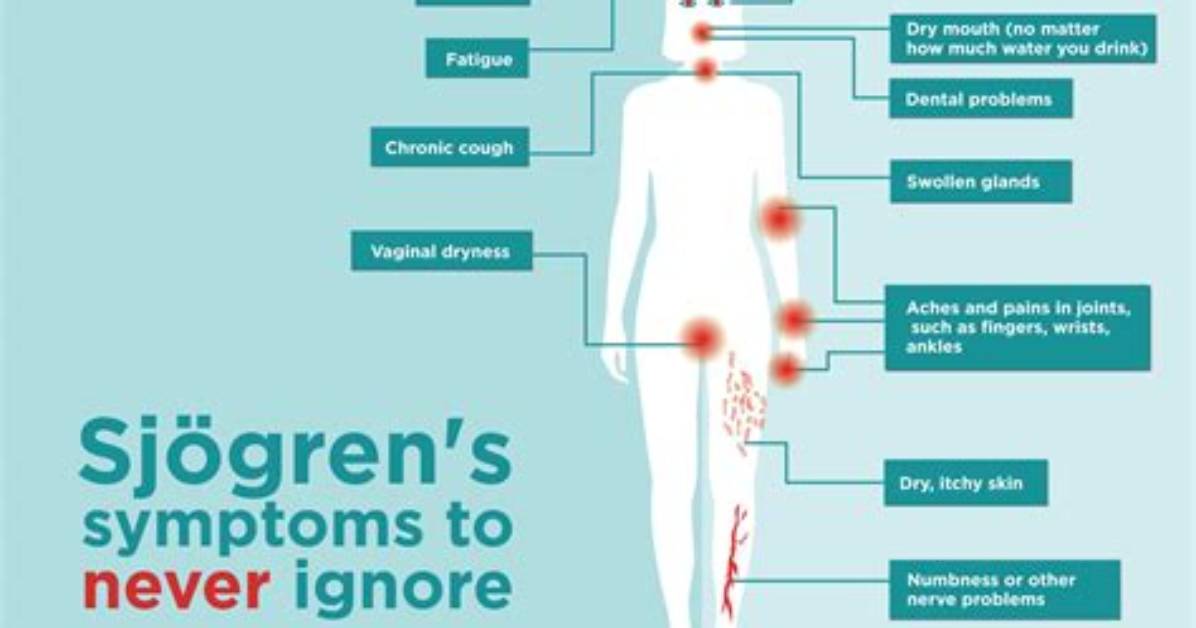 Are Headaches a Symptom of Sjogren's Syndrome?