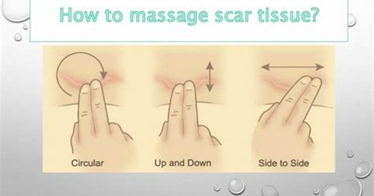 Are You Supposed to Massage Scar Tissue?