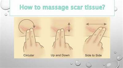 Are You Supposed to Massage Scar Tissue?