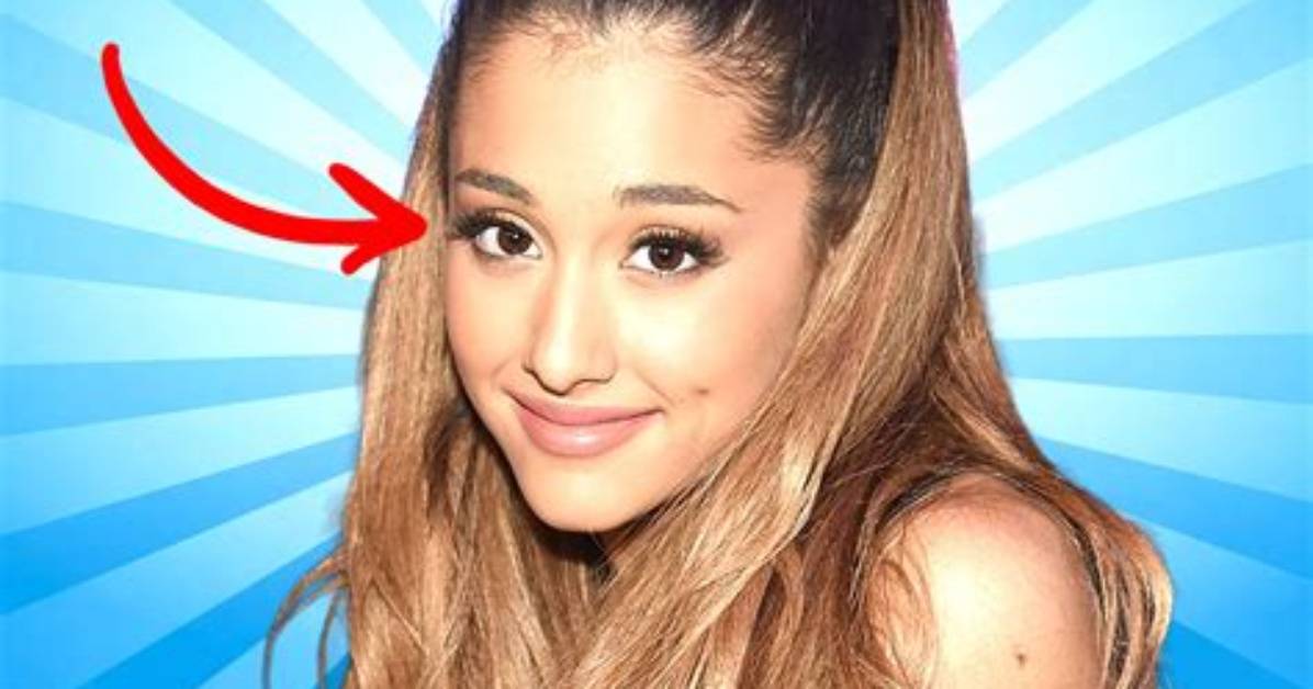 Ariana Grande's Lazy Eye: Debunking the Rumors