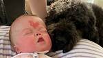 Baby with Dwarfism Inspires Hope