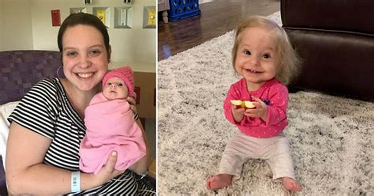 Baby with Dwarfism Inspires