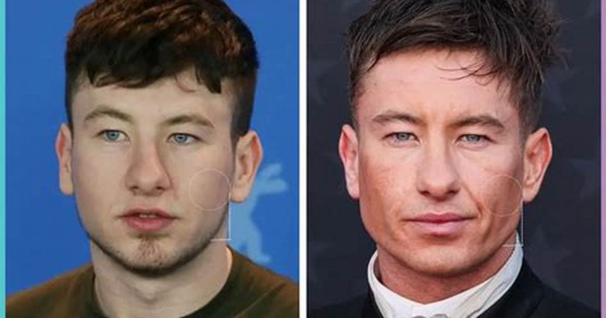 Barry Keoghan S Unbelievable Facial Transformation the Ultimate