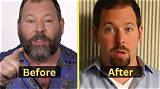 Bert Kreischer Arm Surgery Before and After: Health Update 2023