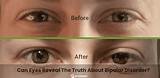 Bipolar Eyes: Understanding the Unique Phenomenon of Color Changing Eyes