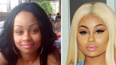 Blac Chyna's Transformation: Before and After