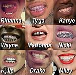 Braces That Look Like Grills: a Unique Fashion Statement