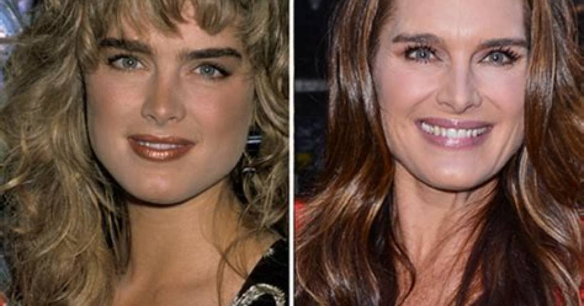 Brooke Shields' Nose Job Before and Its Impact