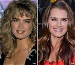 Brooke Shields' Nose Job Before and Its Impact