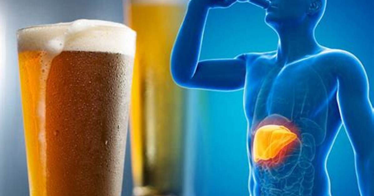 Can 3 Beers a Day Cause Liver Damage?