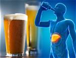 Can 3 Beers a Day Cause Liver Damage?