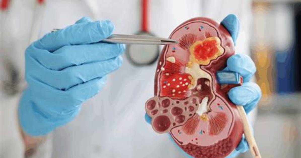 Can a Damaged Kidney Repair Itself?