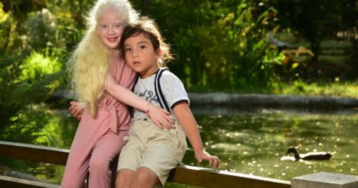 Can Albinos Go to the Beach?