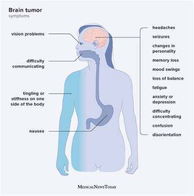 Can Anxiety Feel Like a Brain Tumor?