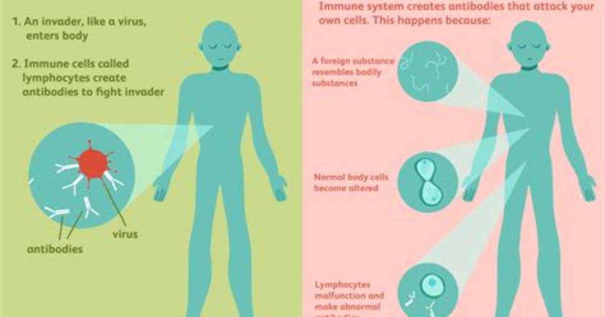 Can Autoimmune Disease Kill You?