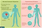 Can Autoimmune Disease Kill You?