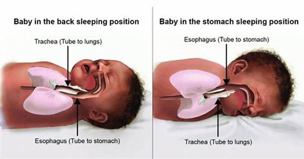 Can Babies Be Born Sleeping?