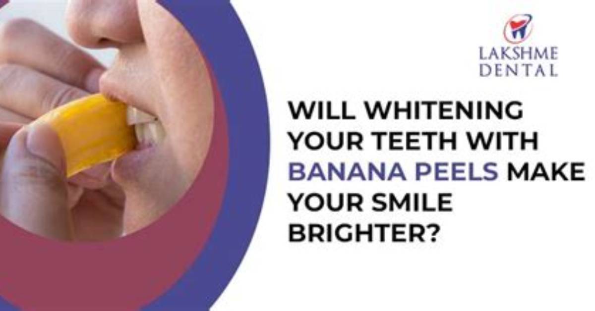 Can Banana Peels Whiten Your Teeth?