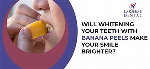 Can Banana Peels Whiten Your Teeth?