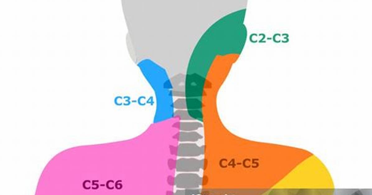 Can C5 C6 Cause Shoulder Pain?