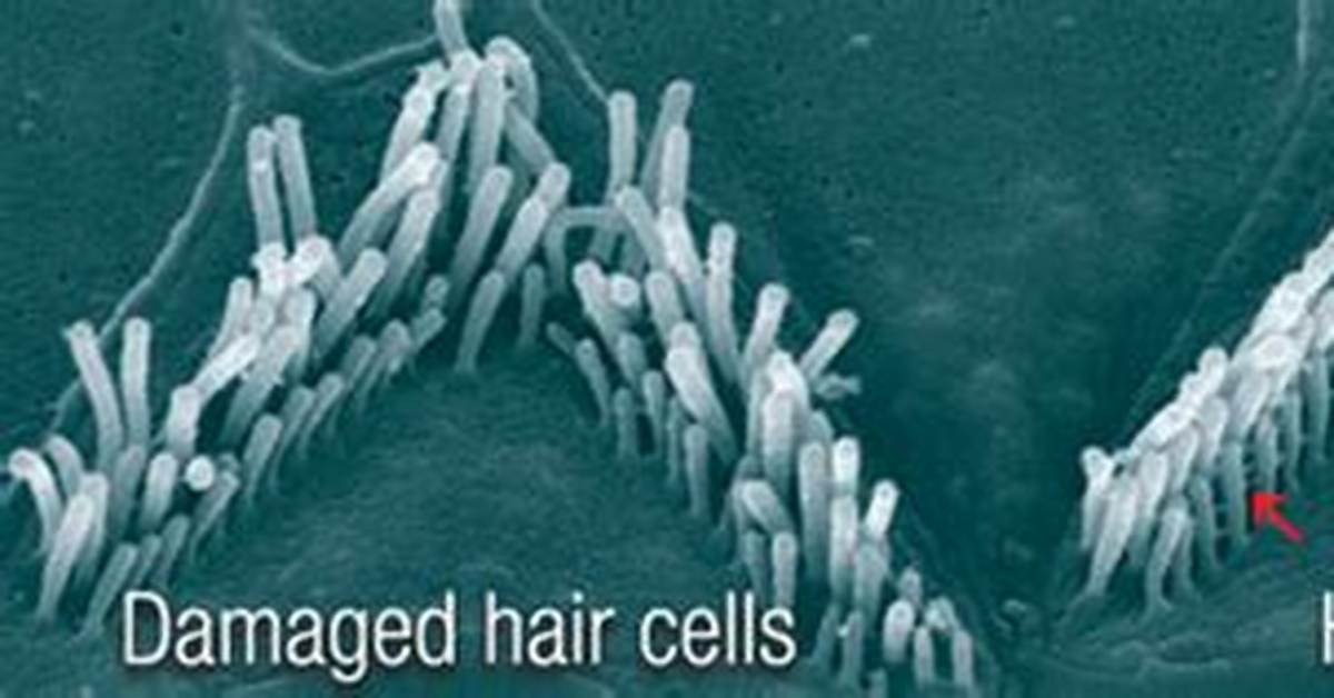 Can Damaged Hair Cells Be Repaired?