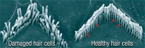 Can Damaged Hair Cells Be Repaired?