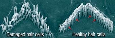 Can Damaged Hair Cells Be Repaired?