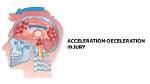 Can Deceleration Kill You?