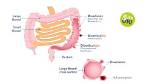 Can Food Get Stuck in Diverticula?