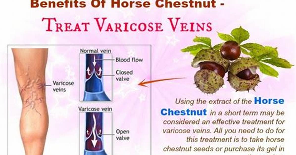 Can Horse Chestnut Cure Varicose Veins?